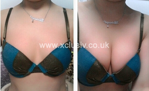 Freebra Self-Adhesive Strapless Backless Bra Secondary image